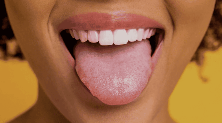 عکس زبان سالم