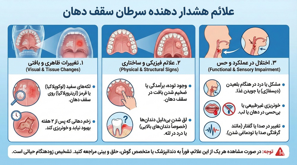سرطان سقف دهان