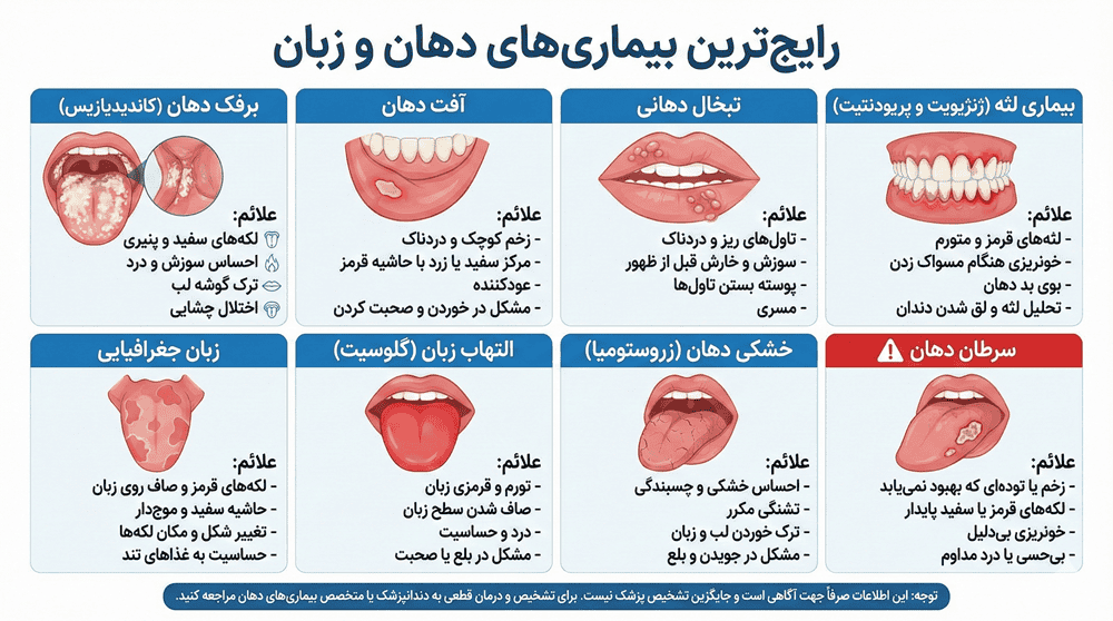 بیماری های دهان و دندان