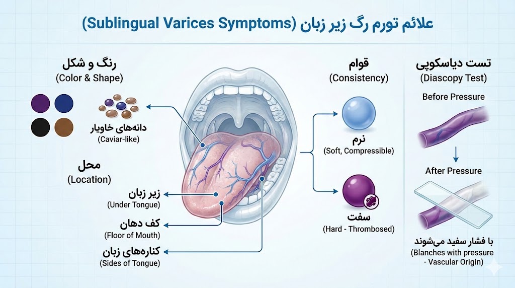 علایم تورم رگ زیر زبان